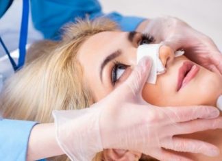 rhinoplasty