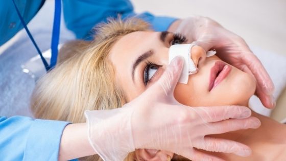rhinoplasty